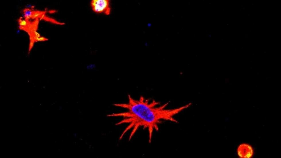 Morfología de un astrocito bioimpreso: el núcleo de la célula que aparece marcado en azul y el resto en rojo muestran un estado muy cercano al que se encuentra en el tejido neural.