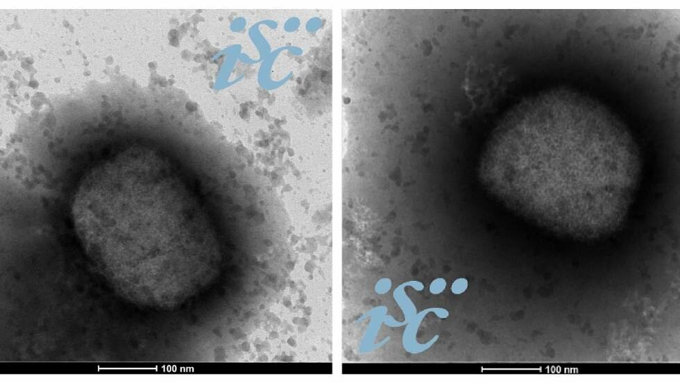 Dos imágenes, obtenidas por microscopía electrónica, del virus de la viruela del mono. Imagen: Unidad de Microscopía Electrónica del ISCIII.
