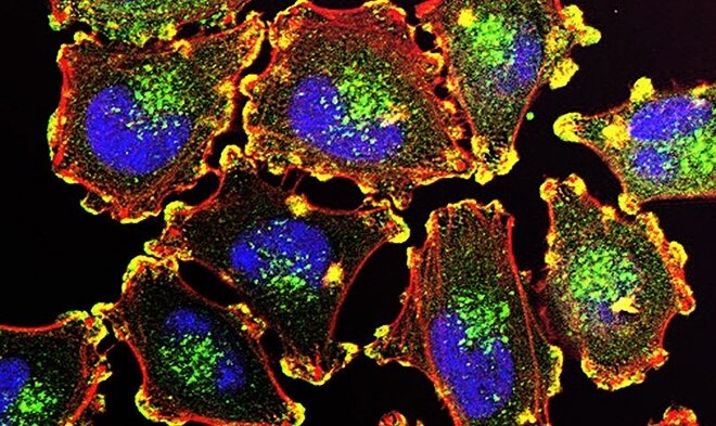 Un péptido diseñado por científicos brasileños retarda el avance de melanomas en pruebas con animales